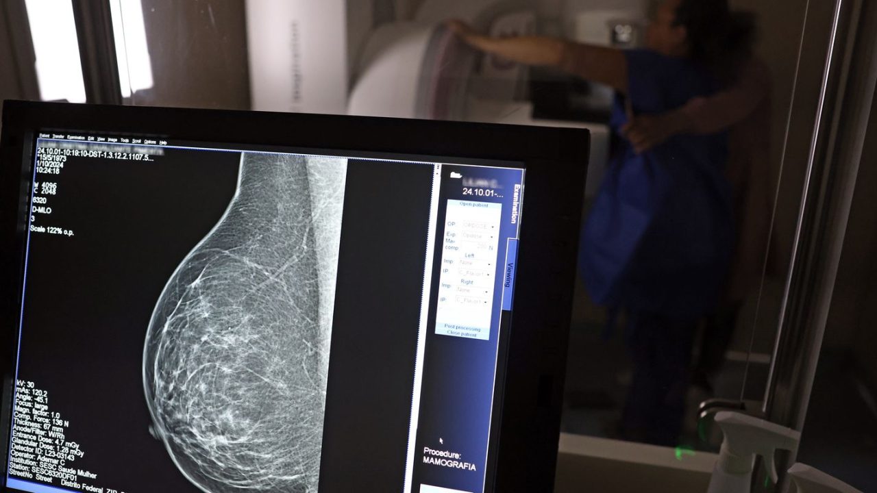 Mulher realizando mamografia em unidade do Instituto Mário Penna em Belo Horizonte